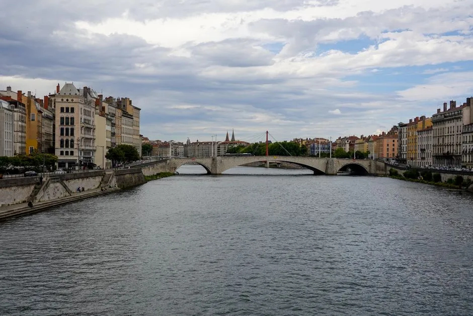 Lyon Clinique De La Sauvegarde, France